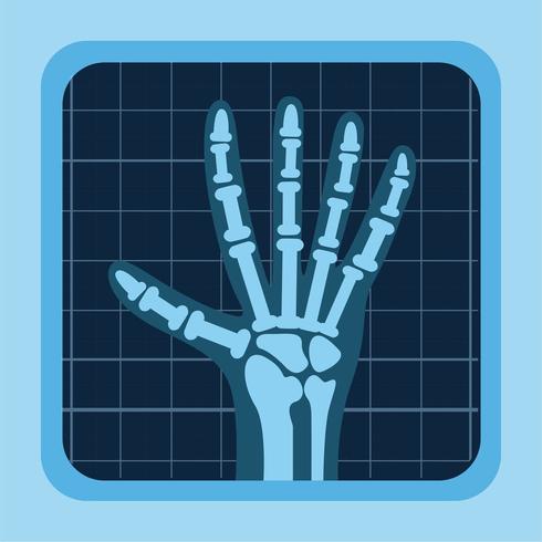 x rays of hand vector