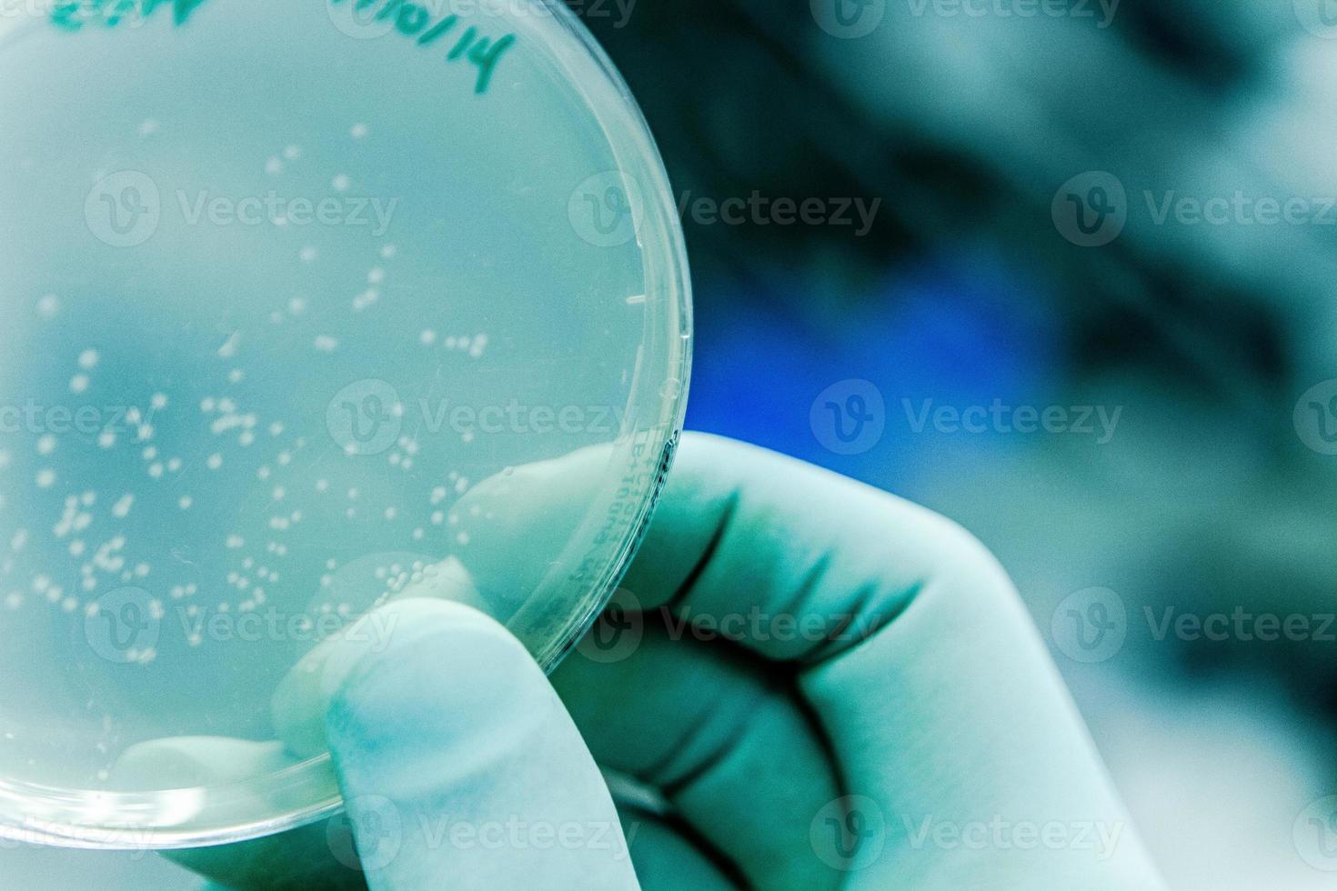 placa de Petri y cultivo de bacterias foto