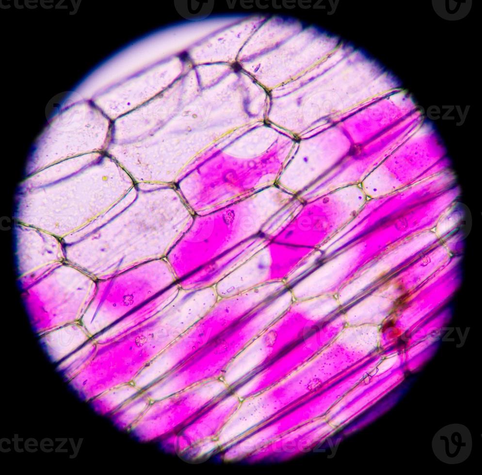 células vegetales bajo microscopio 400x foto