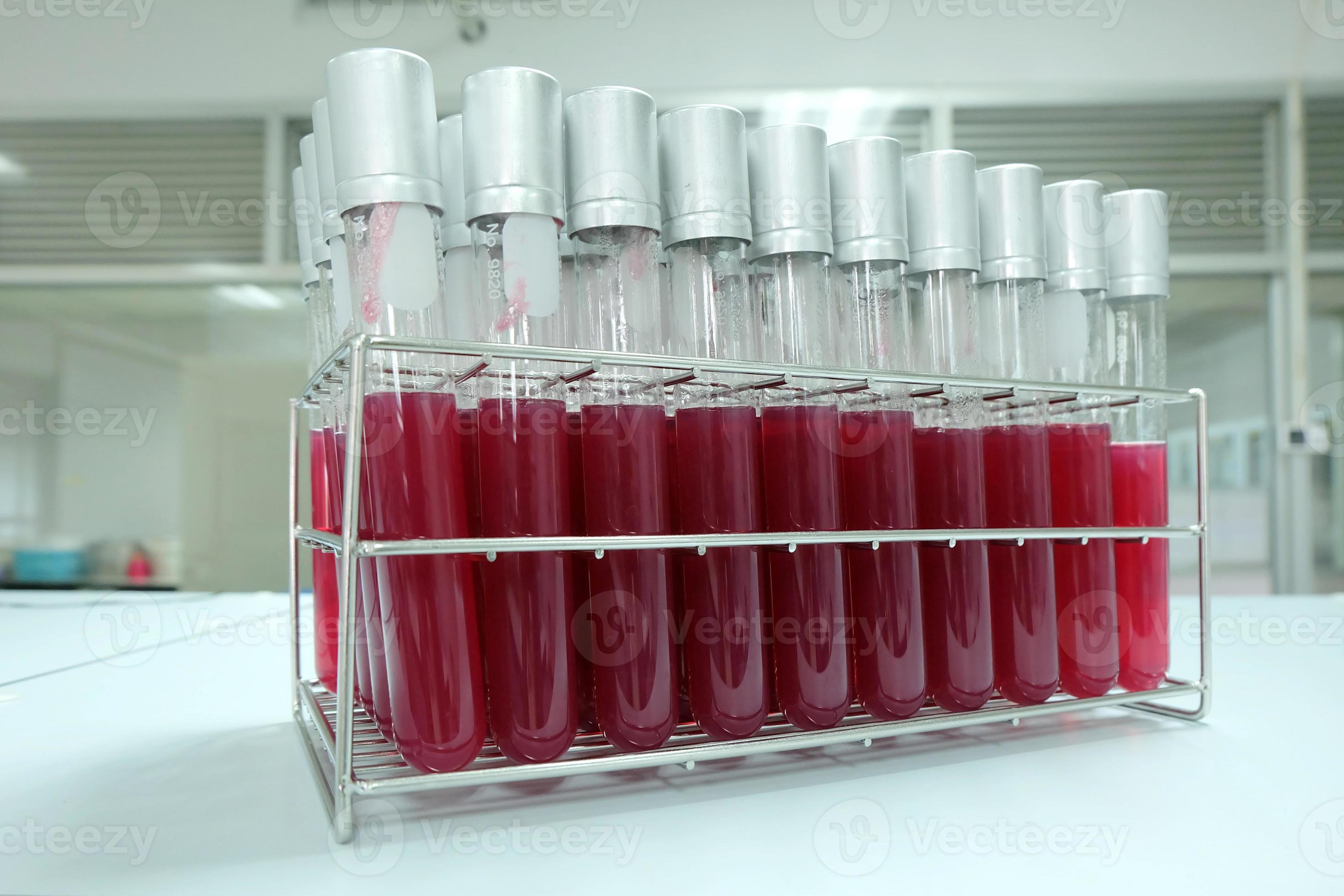 test tube contain yellow media for in microbiology