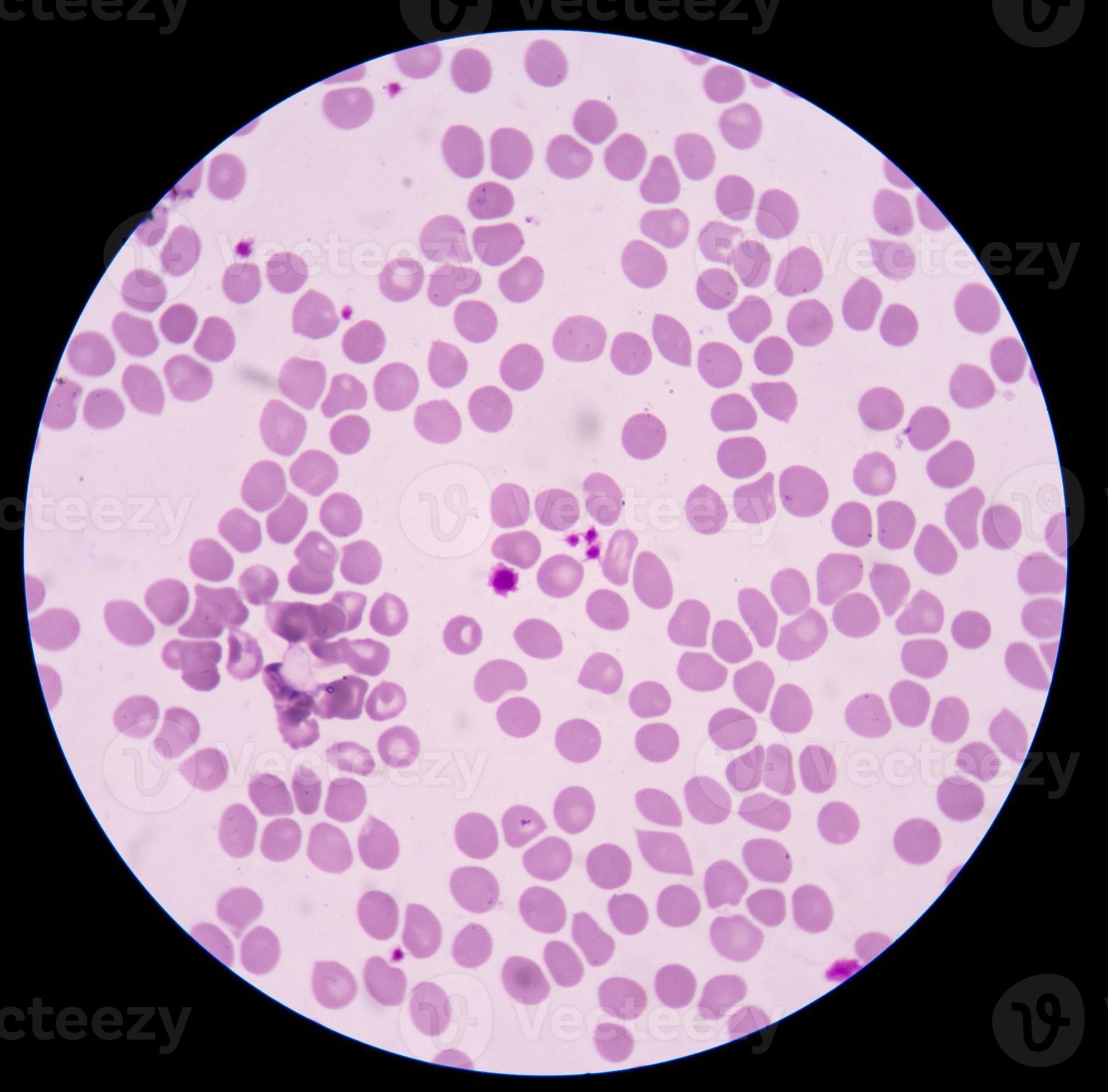 giant platelet 946385 Stock Photo at Vecteezy