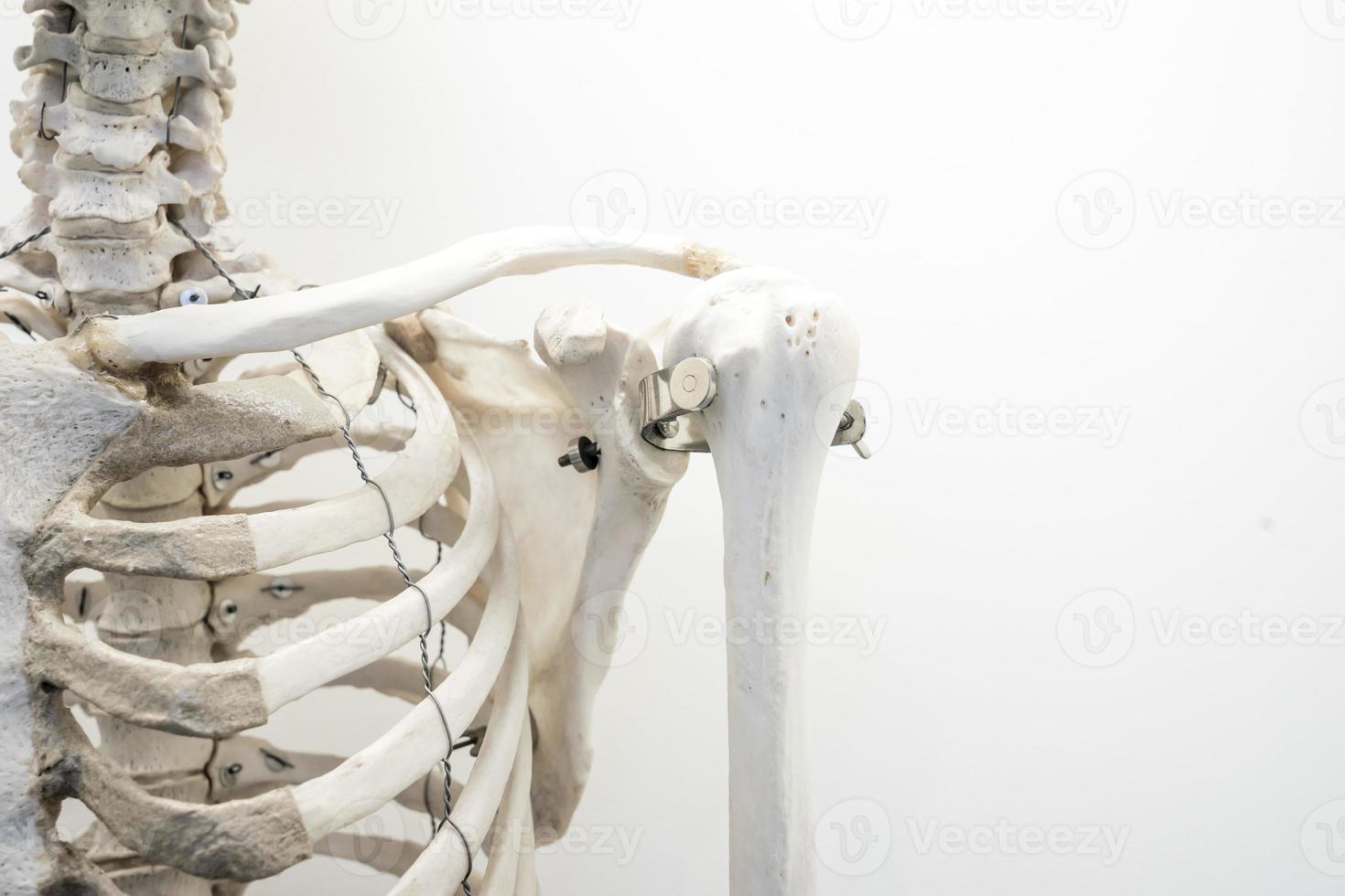 Human Bone marrow structure, shoulder bone pain & inflammation photo