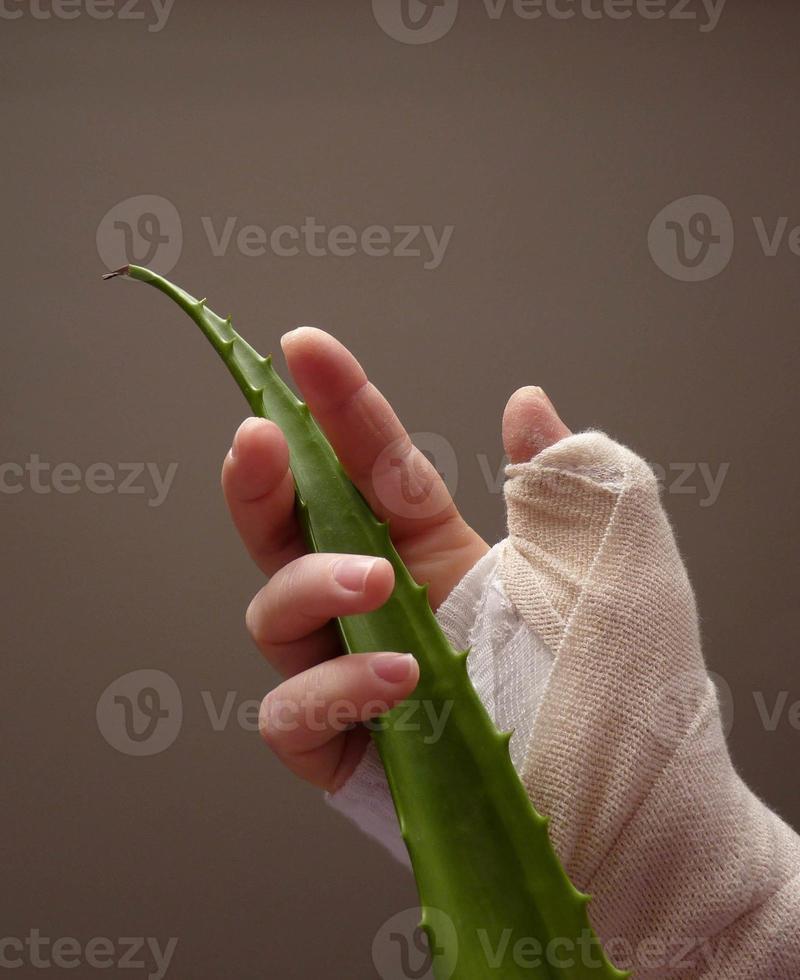 Injured hand with cast holding aloe vera leaf photo