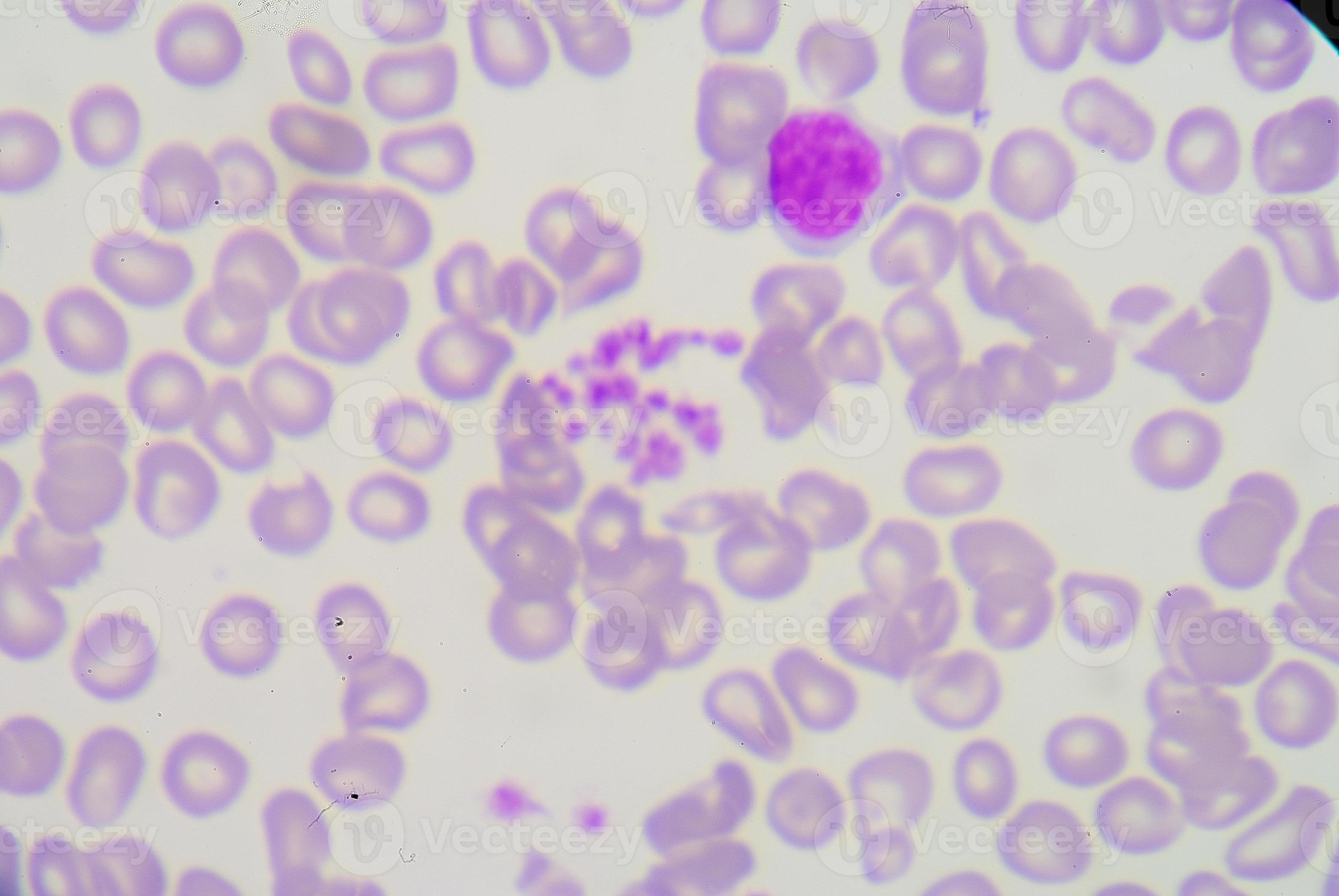 platelet clumping 951137 Stock Photo at Vecteezy