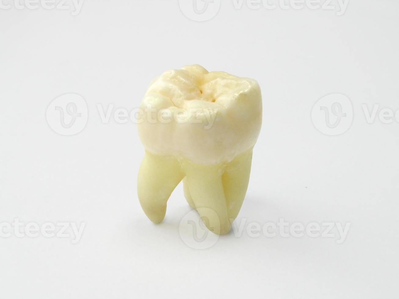 diente molar de cerca foto