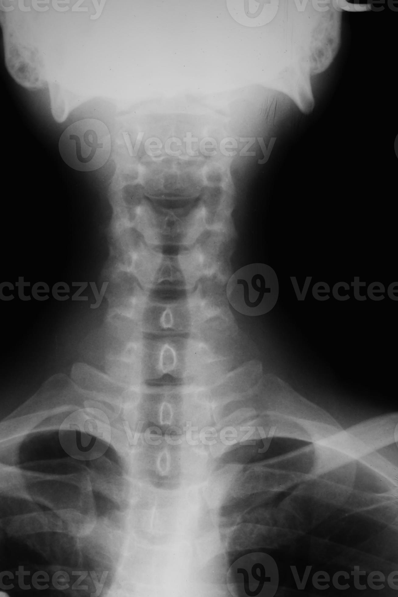 Xrays used in the treatment 956198 Stock Photo at Vecteezy
