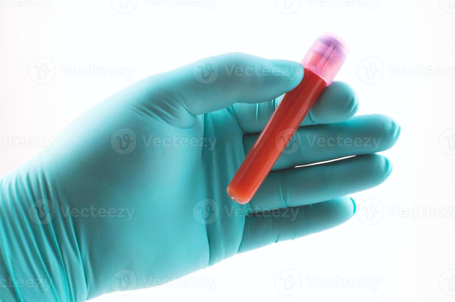 Blood Sample 956376 Stock Photo at Vecteezy