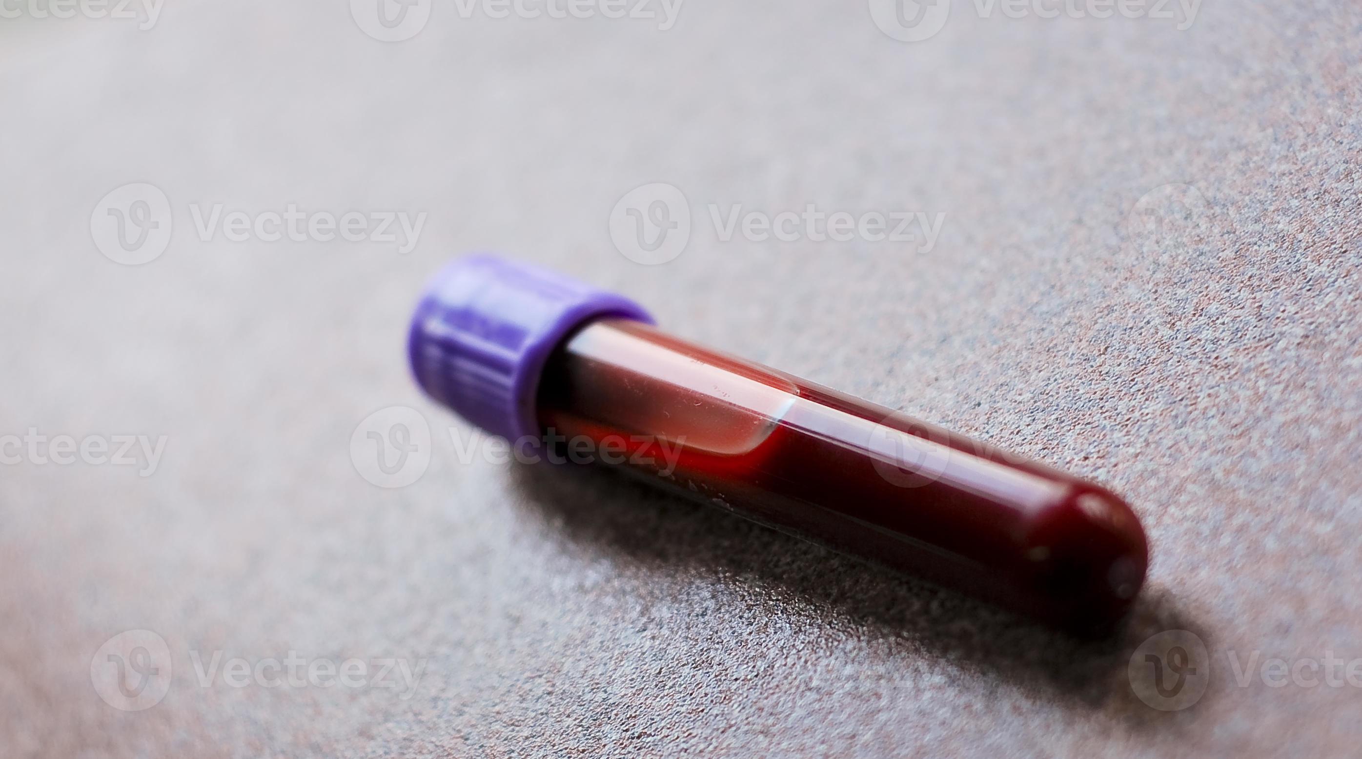 EDTA Tube 961850 Stock Photo at Vecteezy