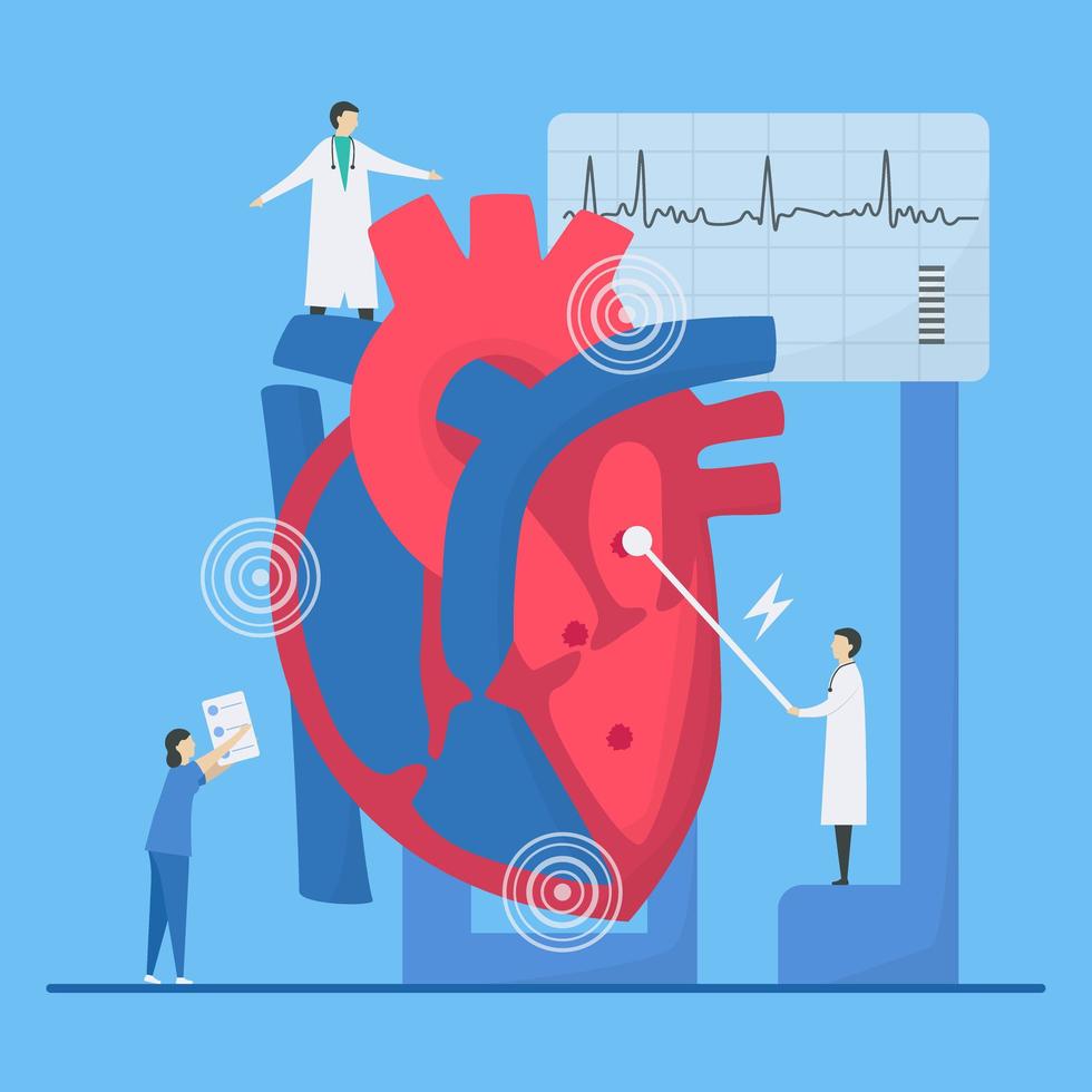 Arrhythmia Concept with Doctor Pointing Out Irregularities vector