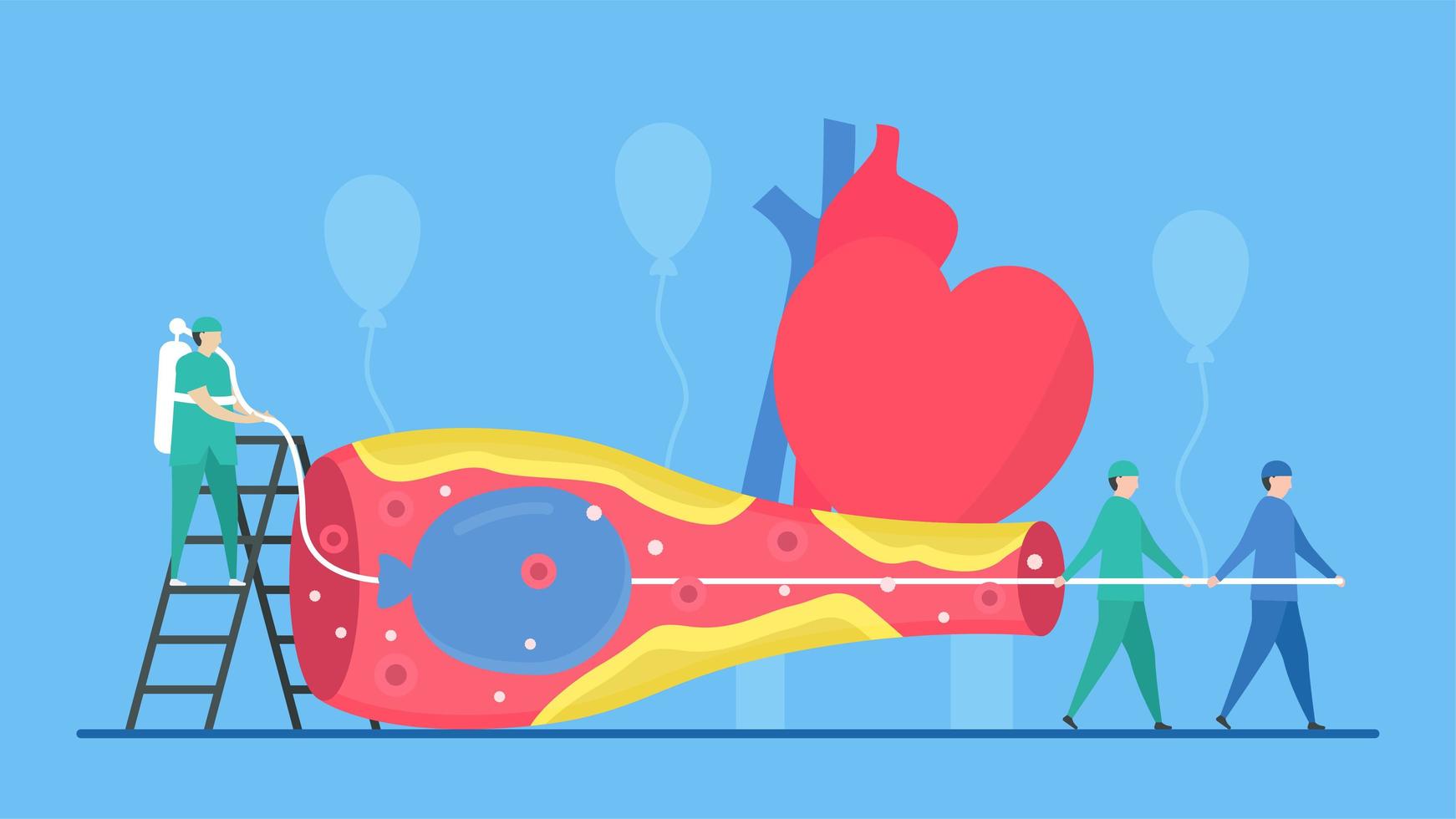 Balloon Angioplasty Concept with Nurses vector