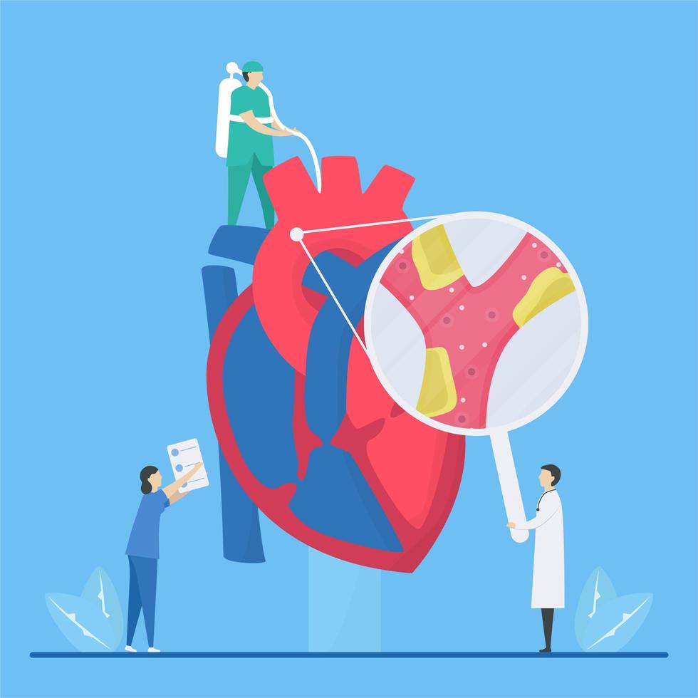 Concepto de aterosclerosis con personal examinando el corazón vector