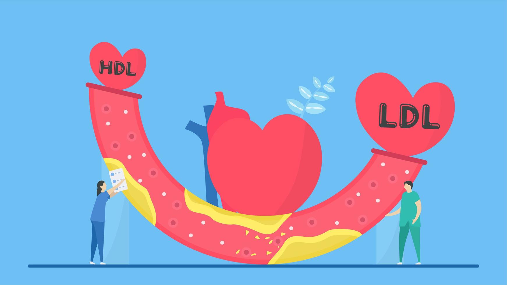 concepto de aterosclerosis con hdl y arteria ldl vector