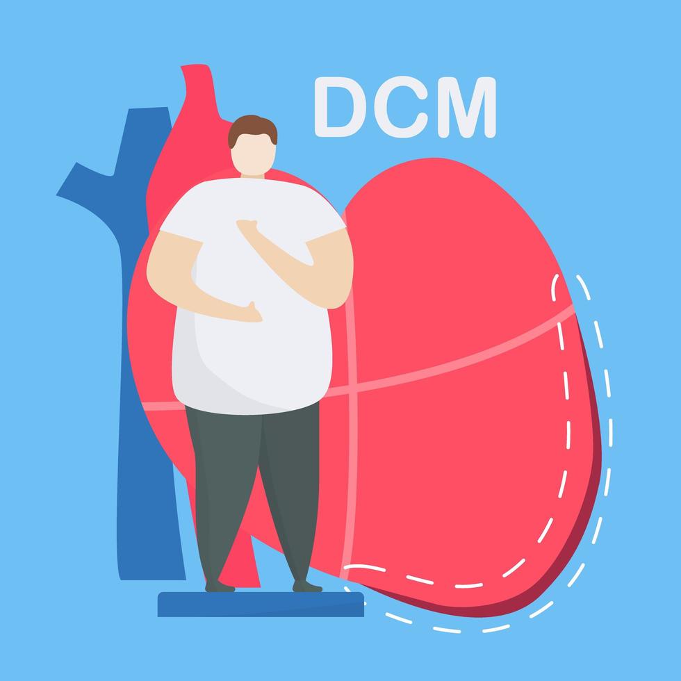 concepto de miocardiopatía dilatada con hombre delante de corazón vector