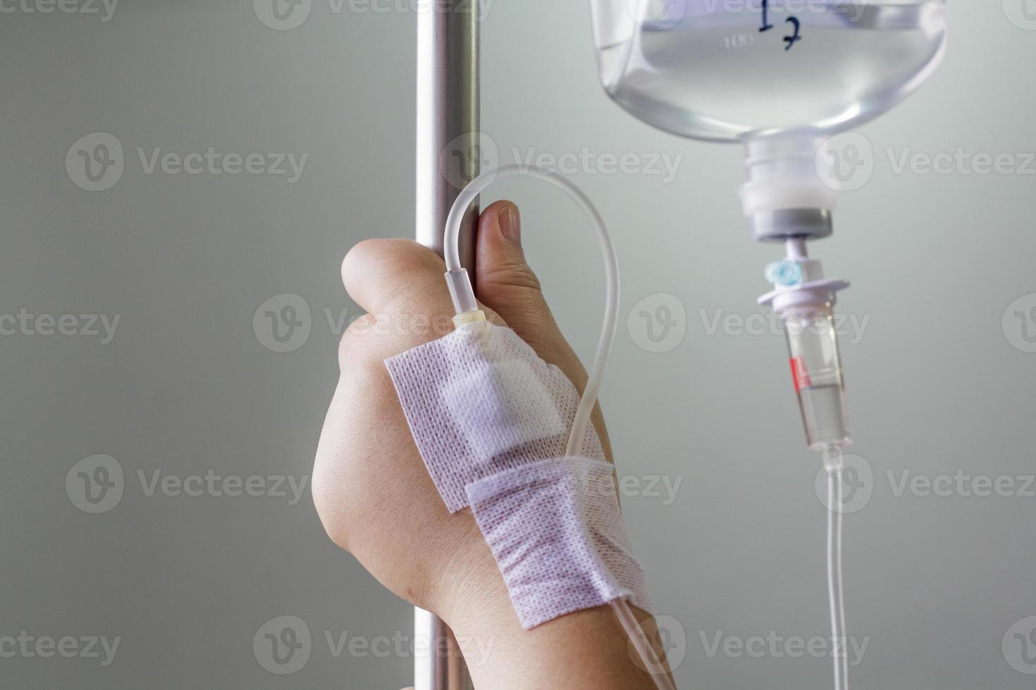 hand swollen by saline intravenous (iv). photo