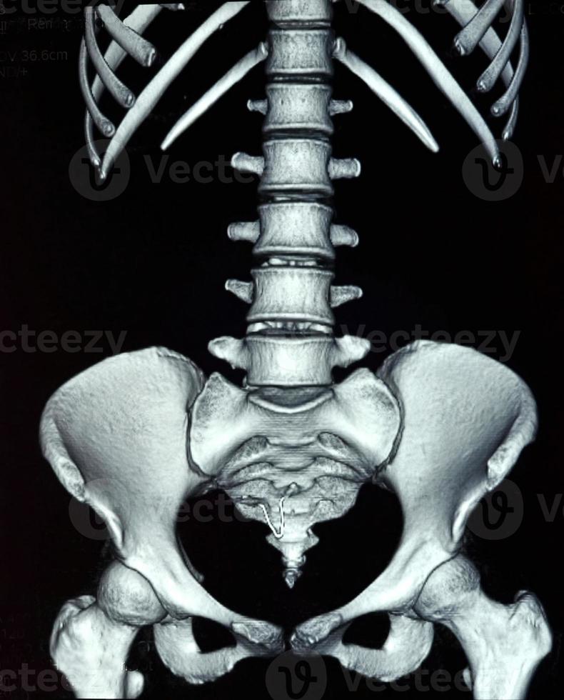 radiografía abdominal foto