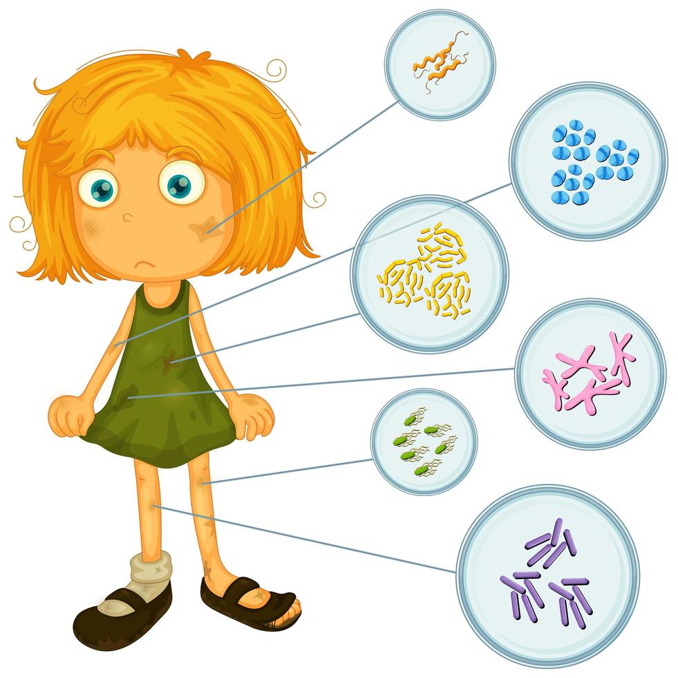 niña con bacterias en el cuerpo vector