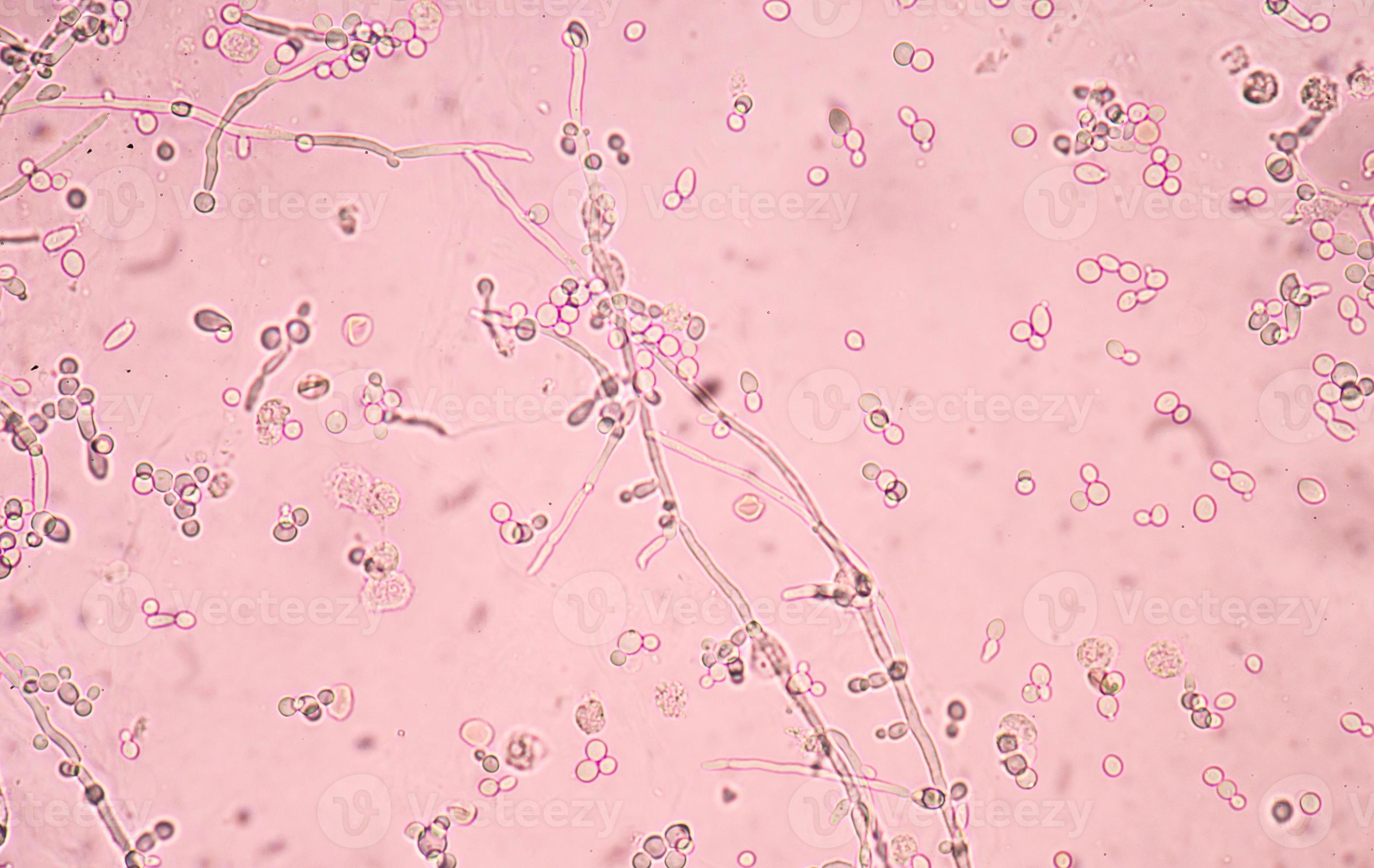 Budding Yeast Cells With Pseudohyphae 1083850 Stock Photo At Vecteezy