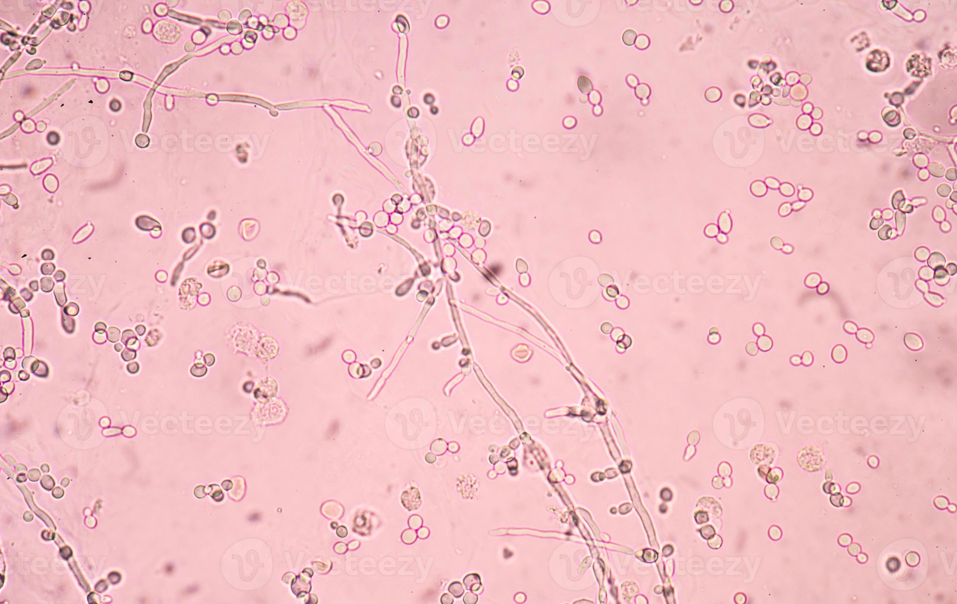 budding yeast cells with pseudohyphae 1083850 Stock Photo at Vecteezy