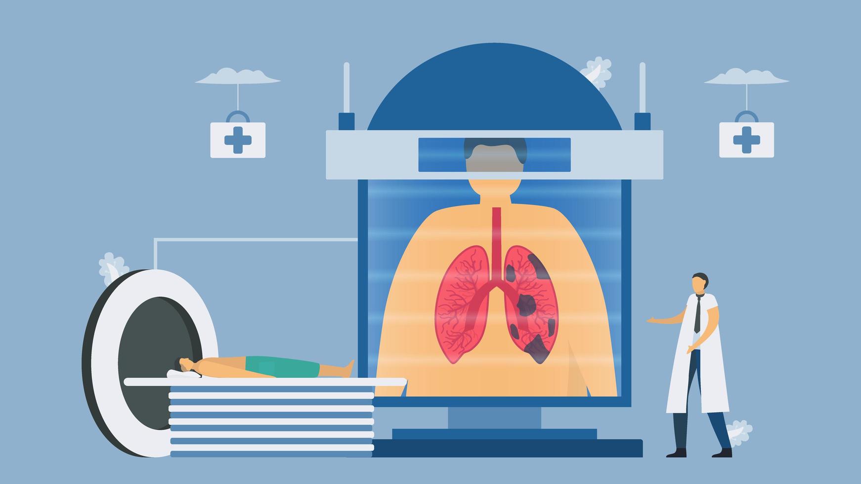 Sistemas de tomografía computarizada para pruebas de enfermedad pulmonar obstructiva crónica vector