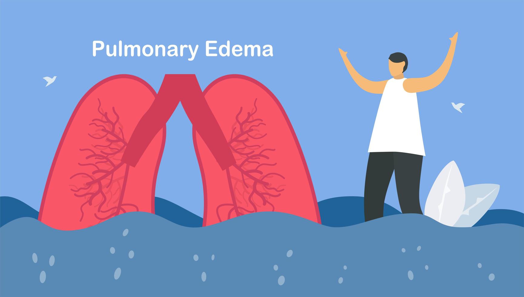 Pulmonary edema is symptom that lungs fill with fluid vector