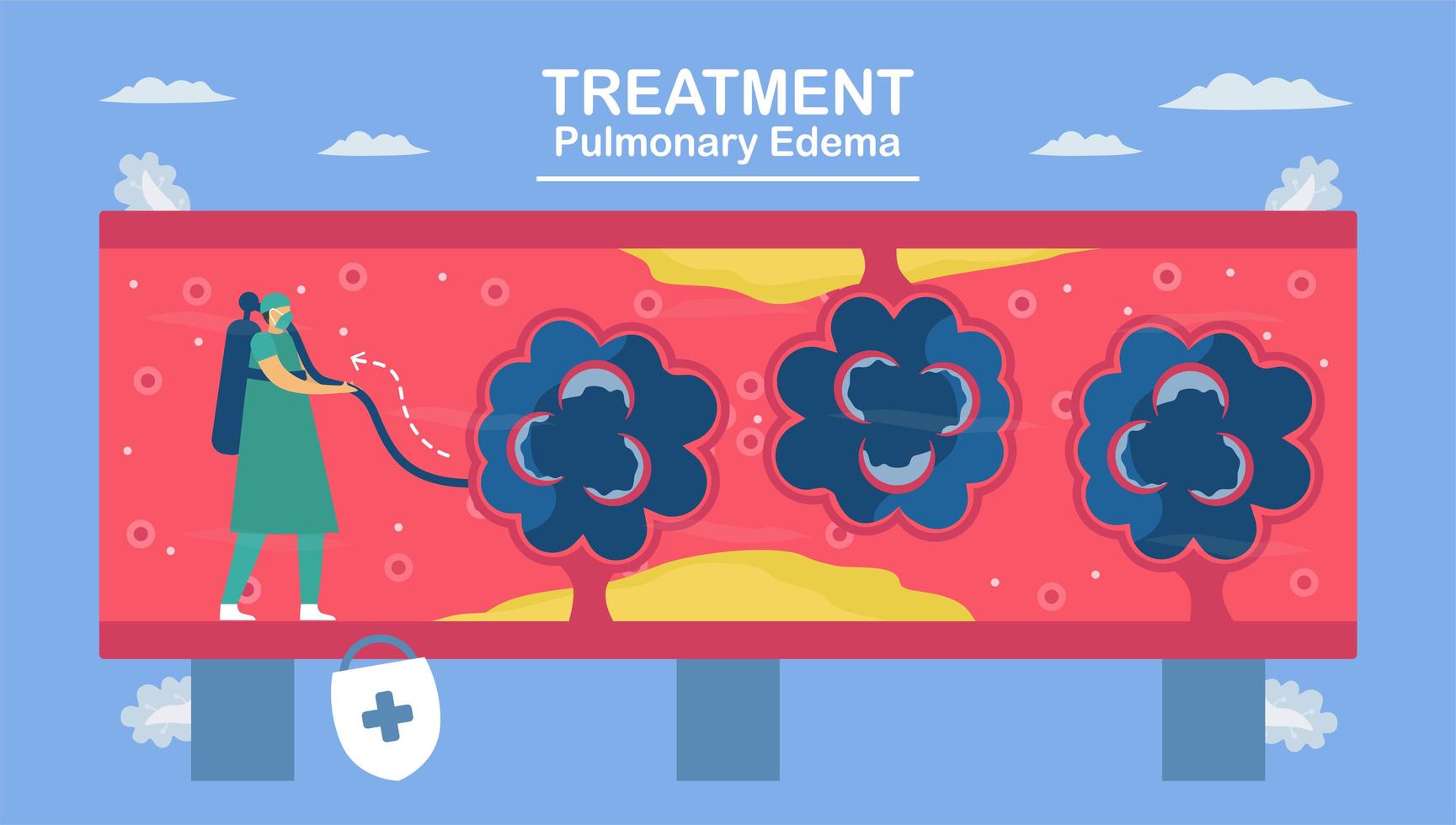 Pulmonary edema is symptom. vector