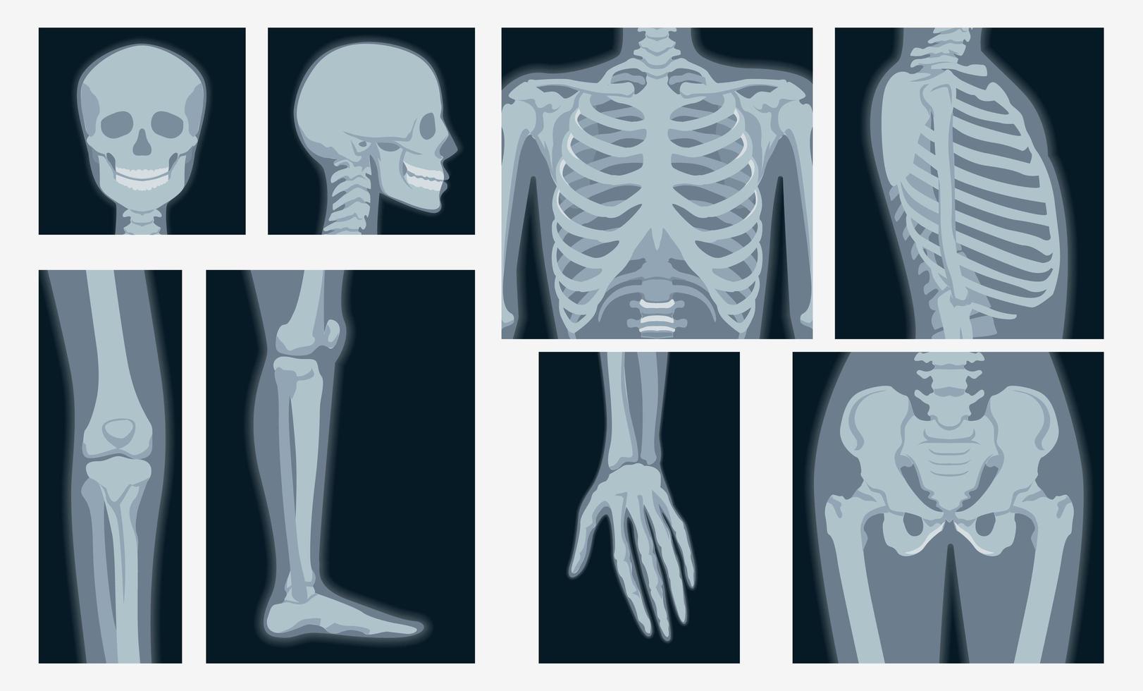 Different x-rays shot of human body part set vector