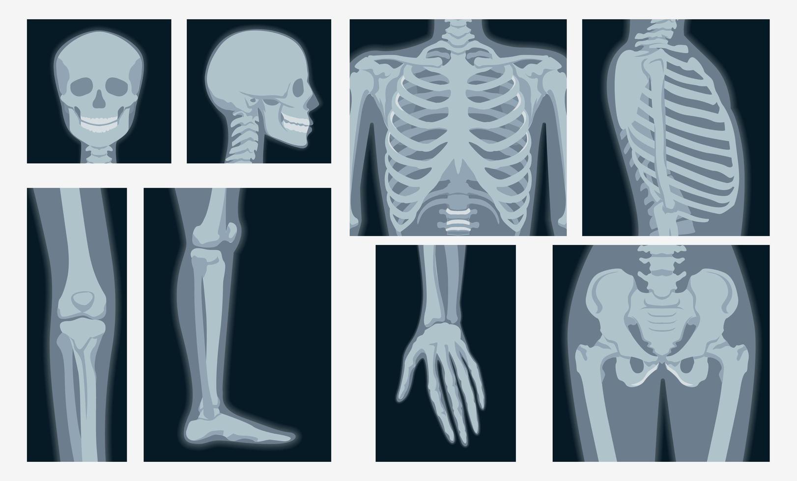 diferentes tomas de rayos X del conjunto de partes del cuerpo humano vector