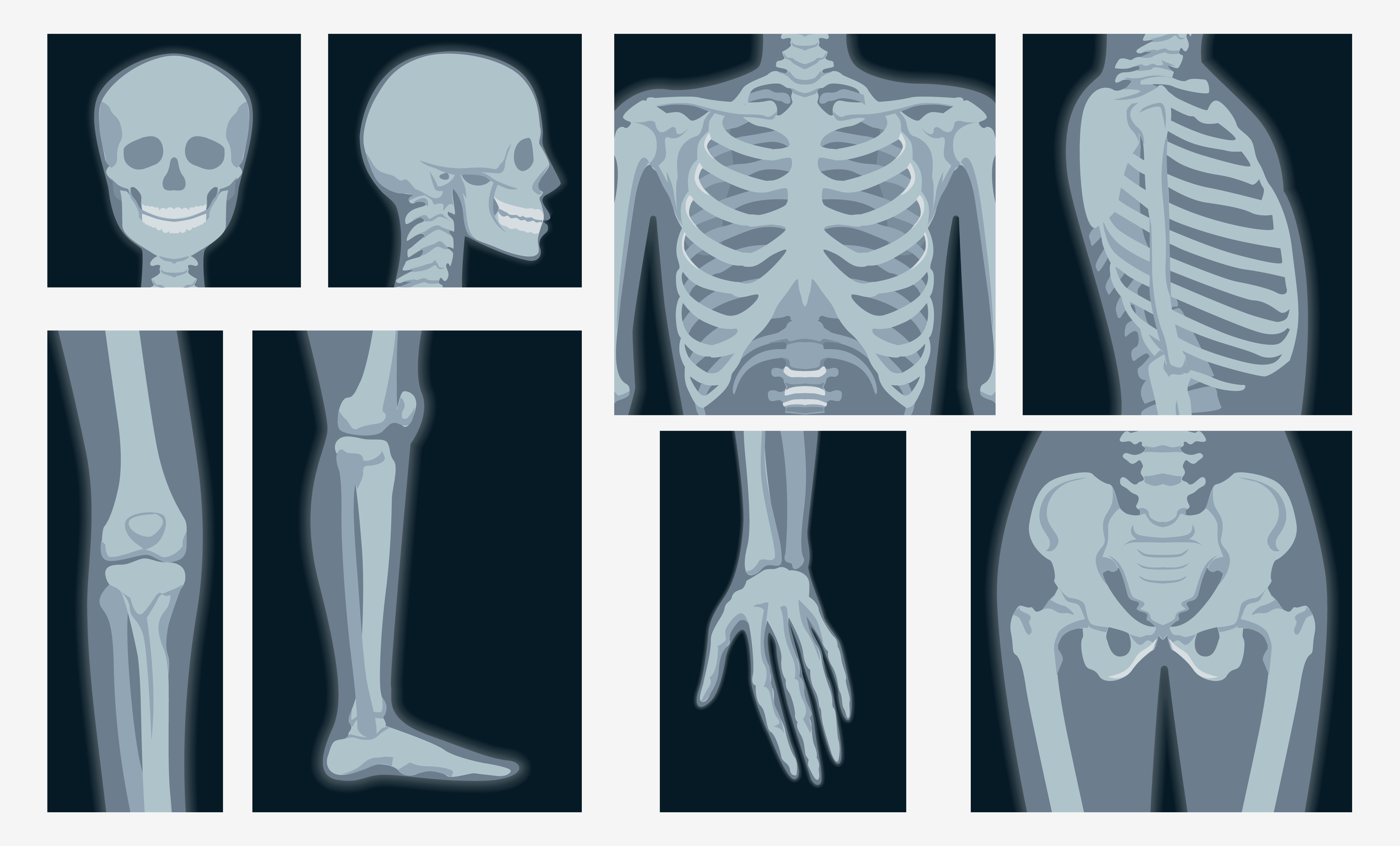 Different xrays shot of human body part set 1233807 Vector Art at Vecteezy