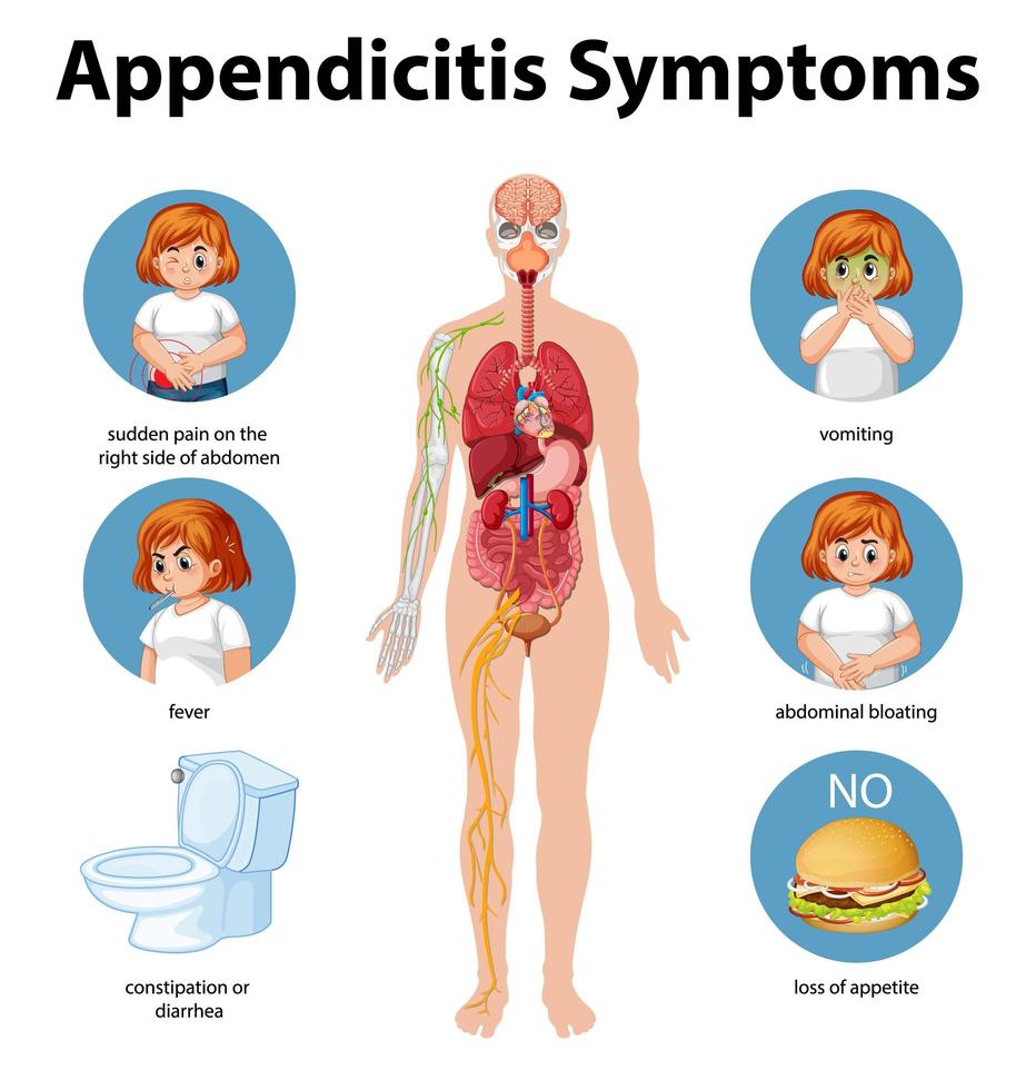 infografía de información de síntomas de apendicitis vector