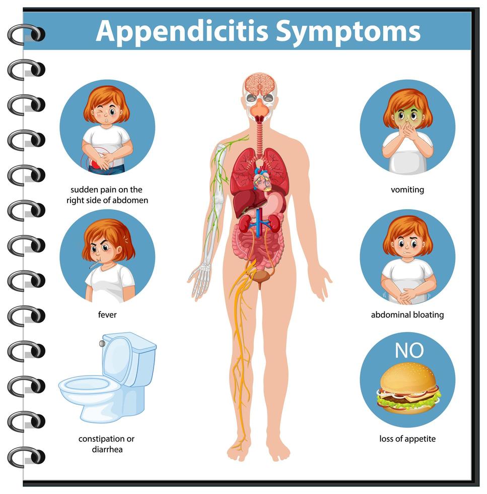 infografía de información de síntomas de apendicitis vector