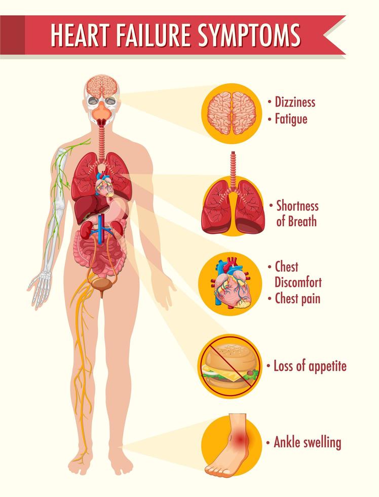 Heart failure symptoms information infographic vector