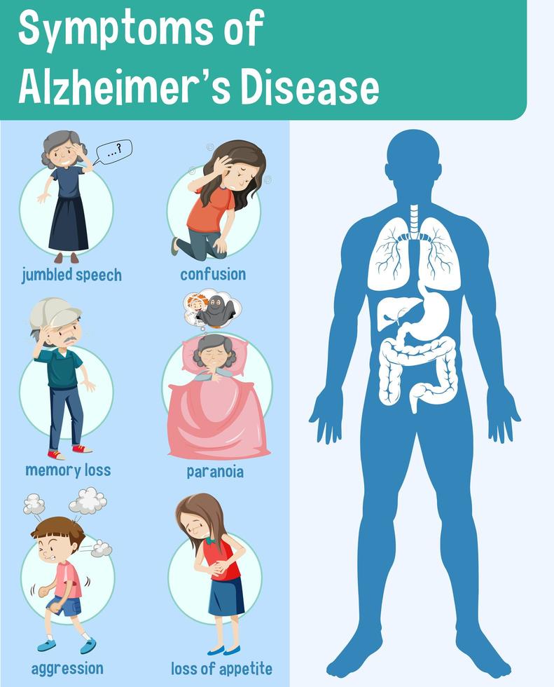 síntomas de la enfermedad de alzheimer infografía vector