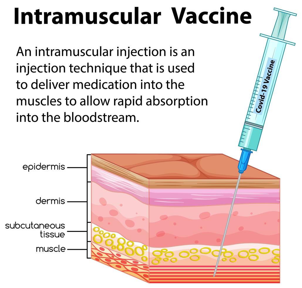 vector de información sobre inyección intramuscular.