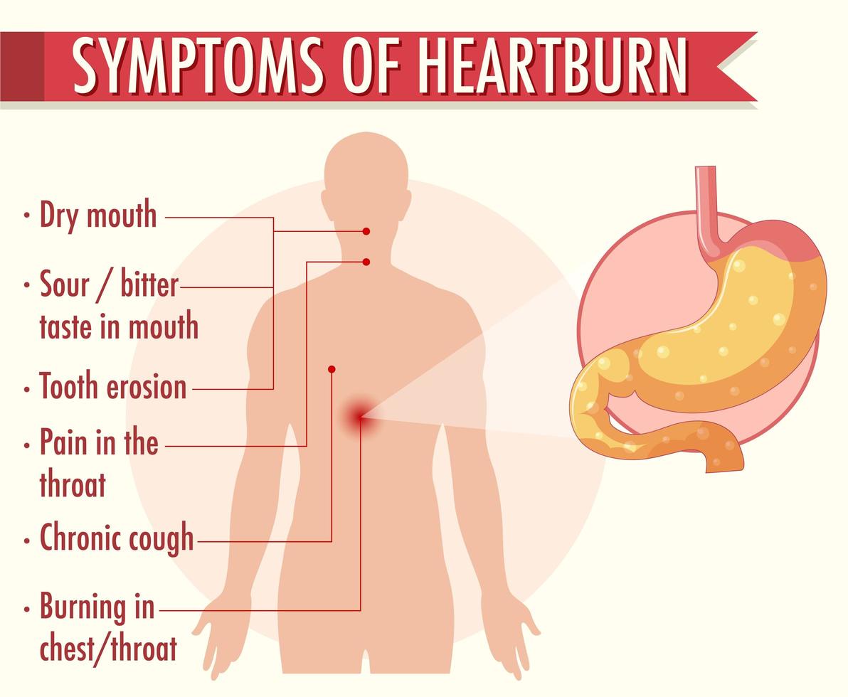 infografía de información de síntomas de acidez estomacal vector
