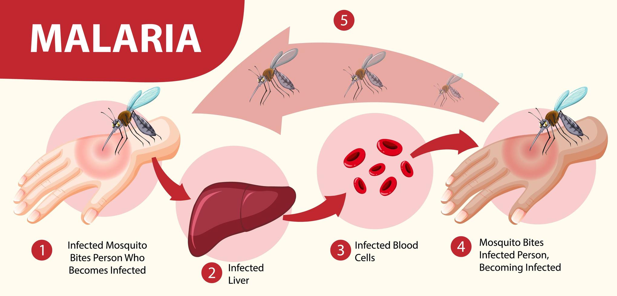 infografía de información de síntomas de malaria vector