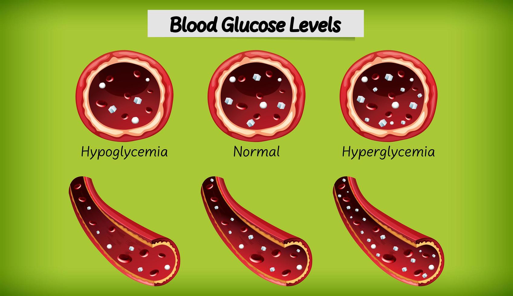 Medical blood glucose level vector
