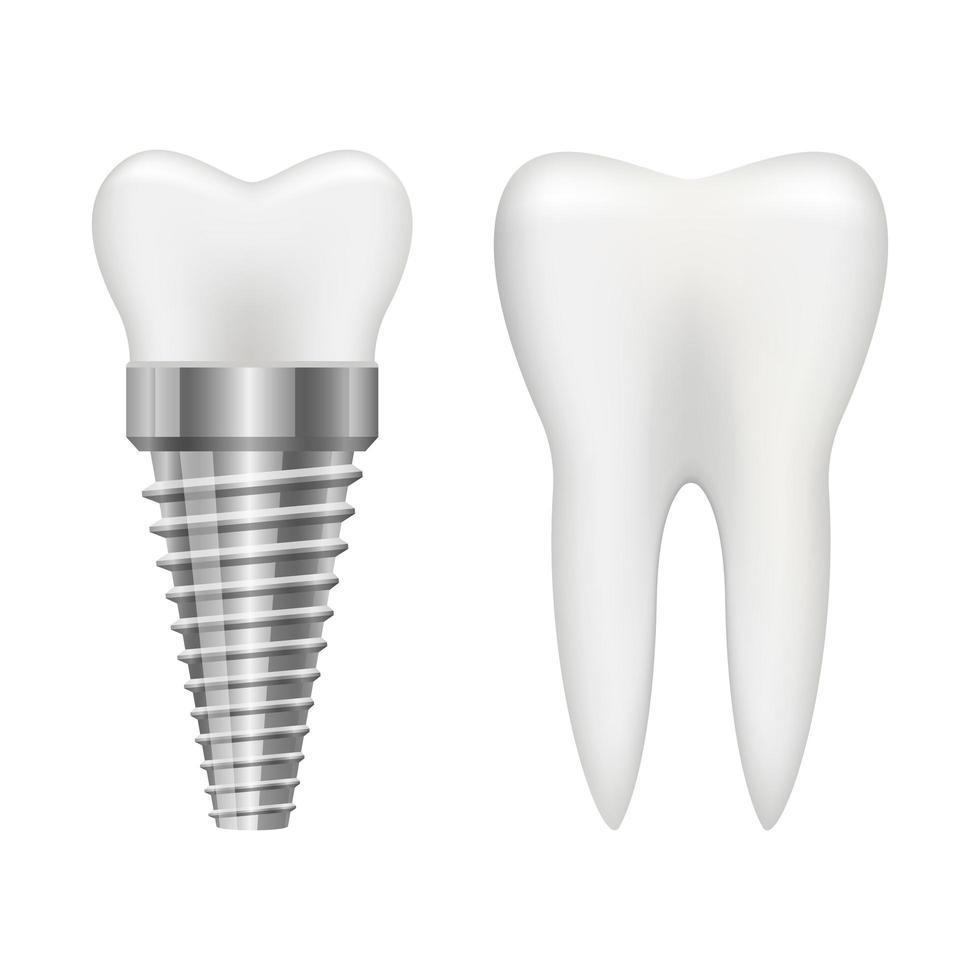 Tooth implant vector design illustration isolated on white background