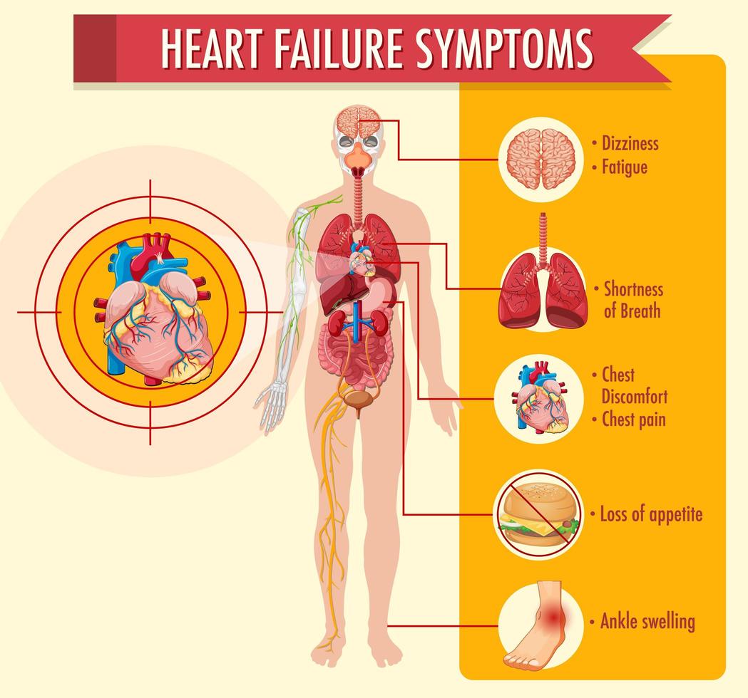 Heart failure symptoms information infographic vector