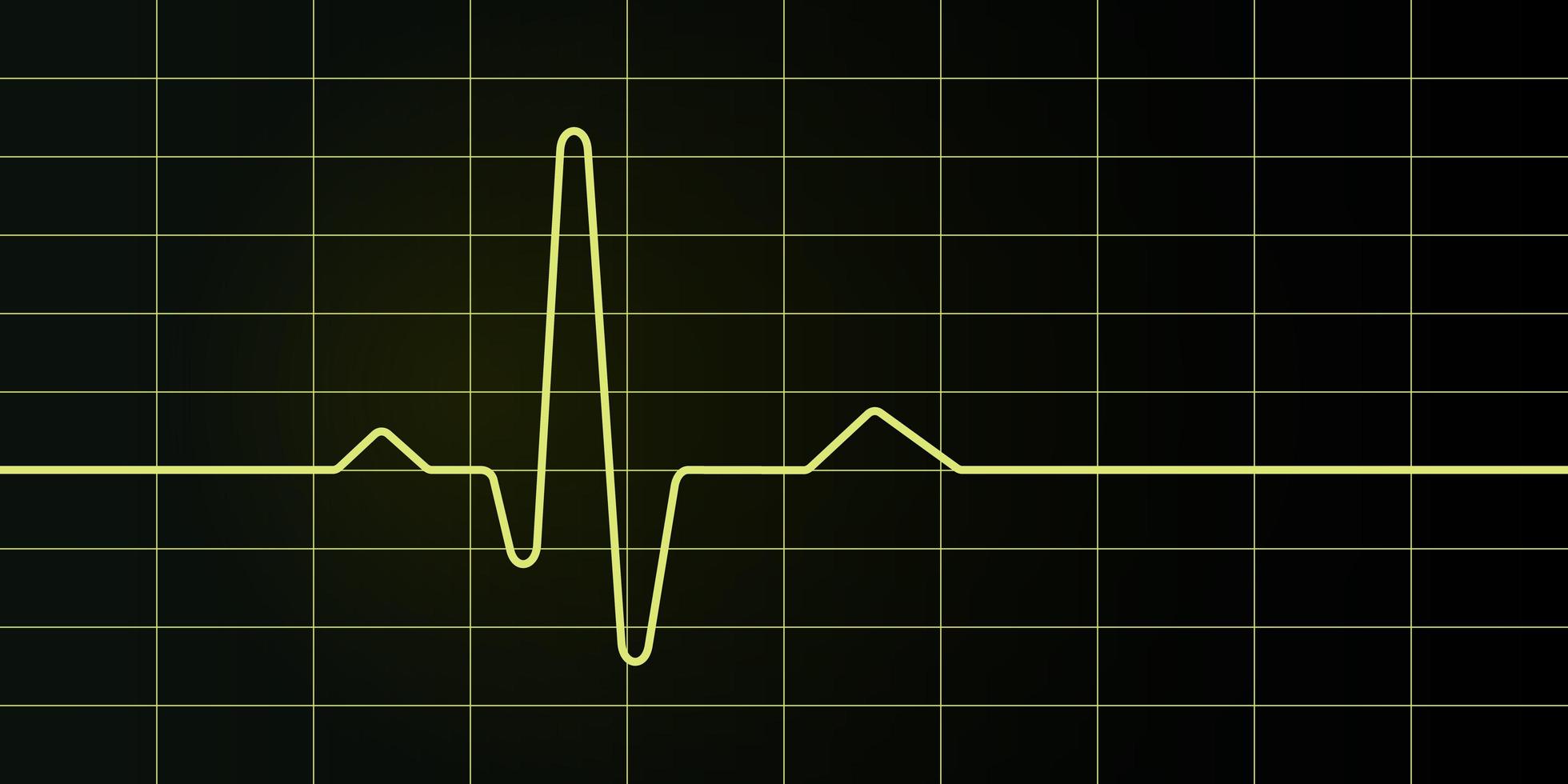 Electrocardiogram screen and graph vector