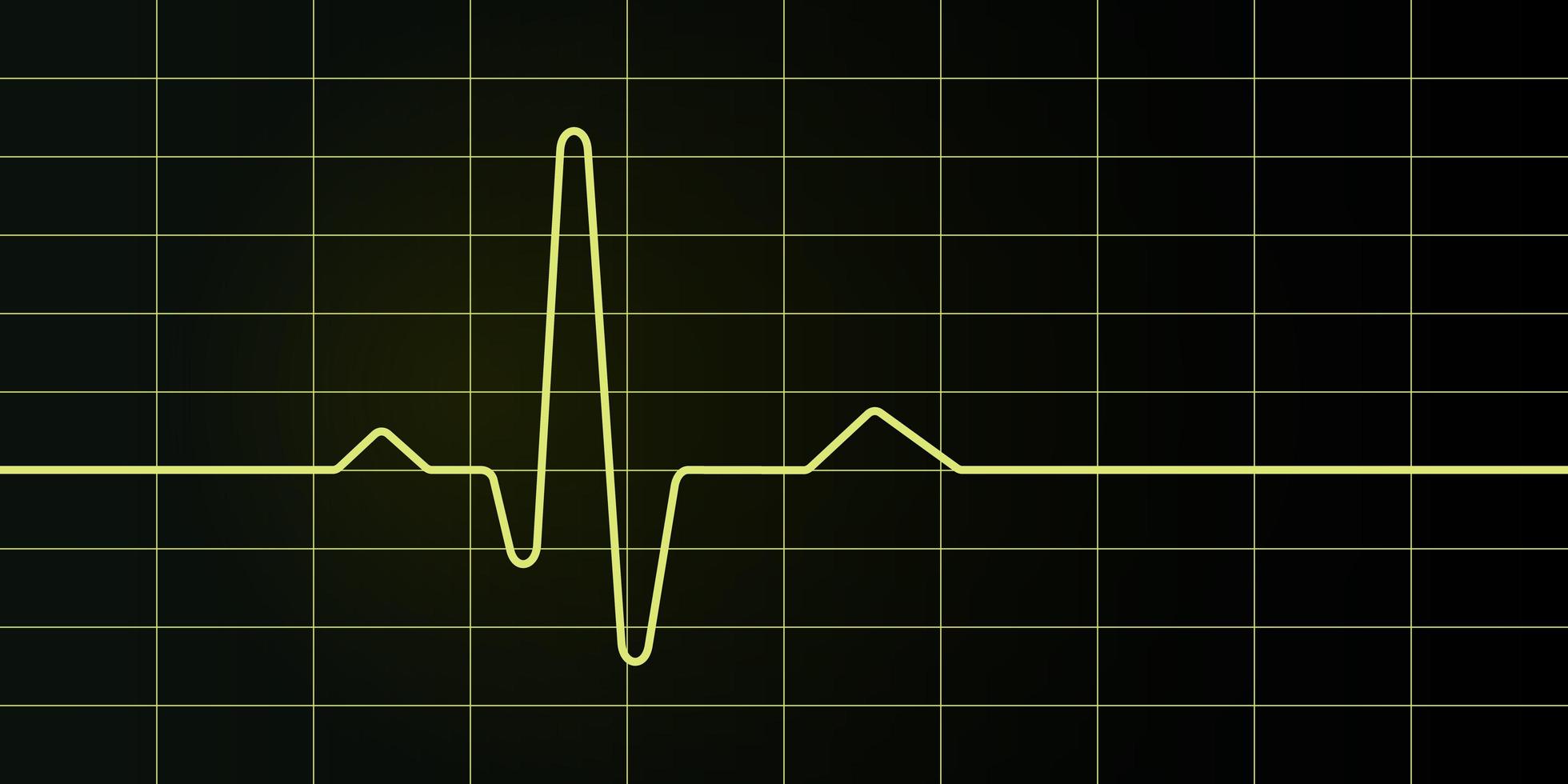 Pantalla y gráfico de electrocardiograma. vector