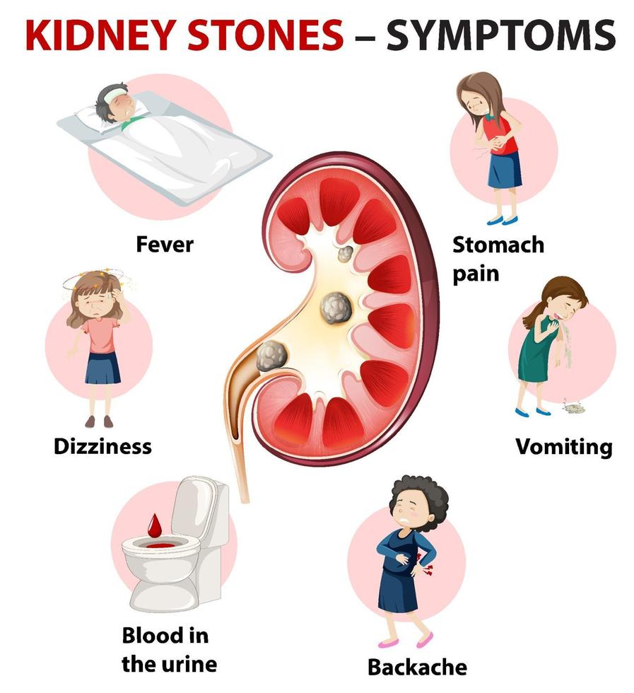 Kidney stones symptoms cartoon style infographic vector