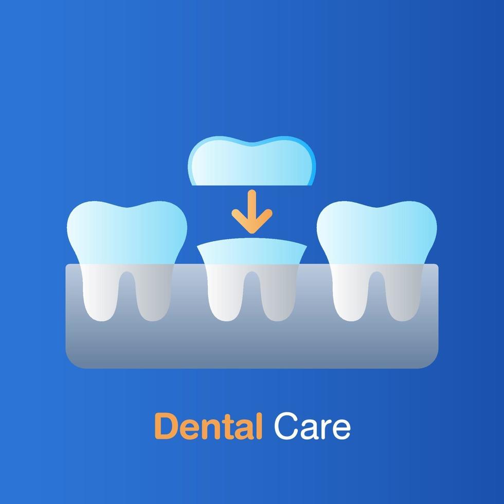 concepto de cuidado dental. odontología implantológica, prevención, chequeo y tratamiento odontológico. vector