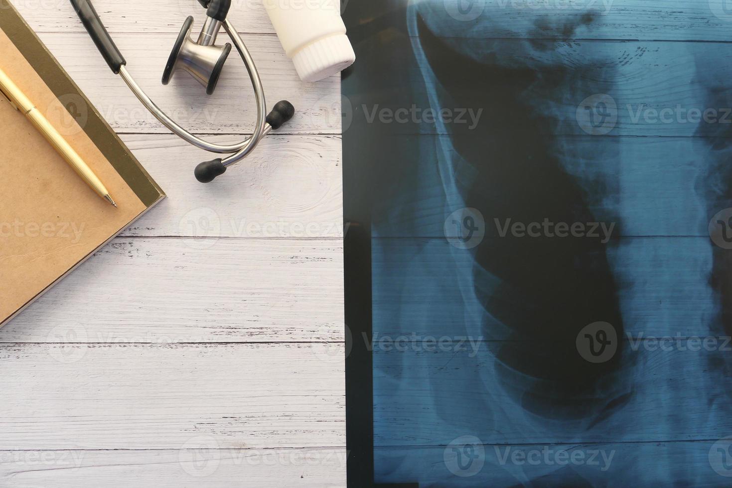 X ray photography, digital tablet on white background photo