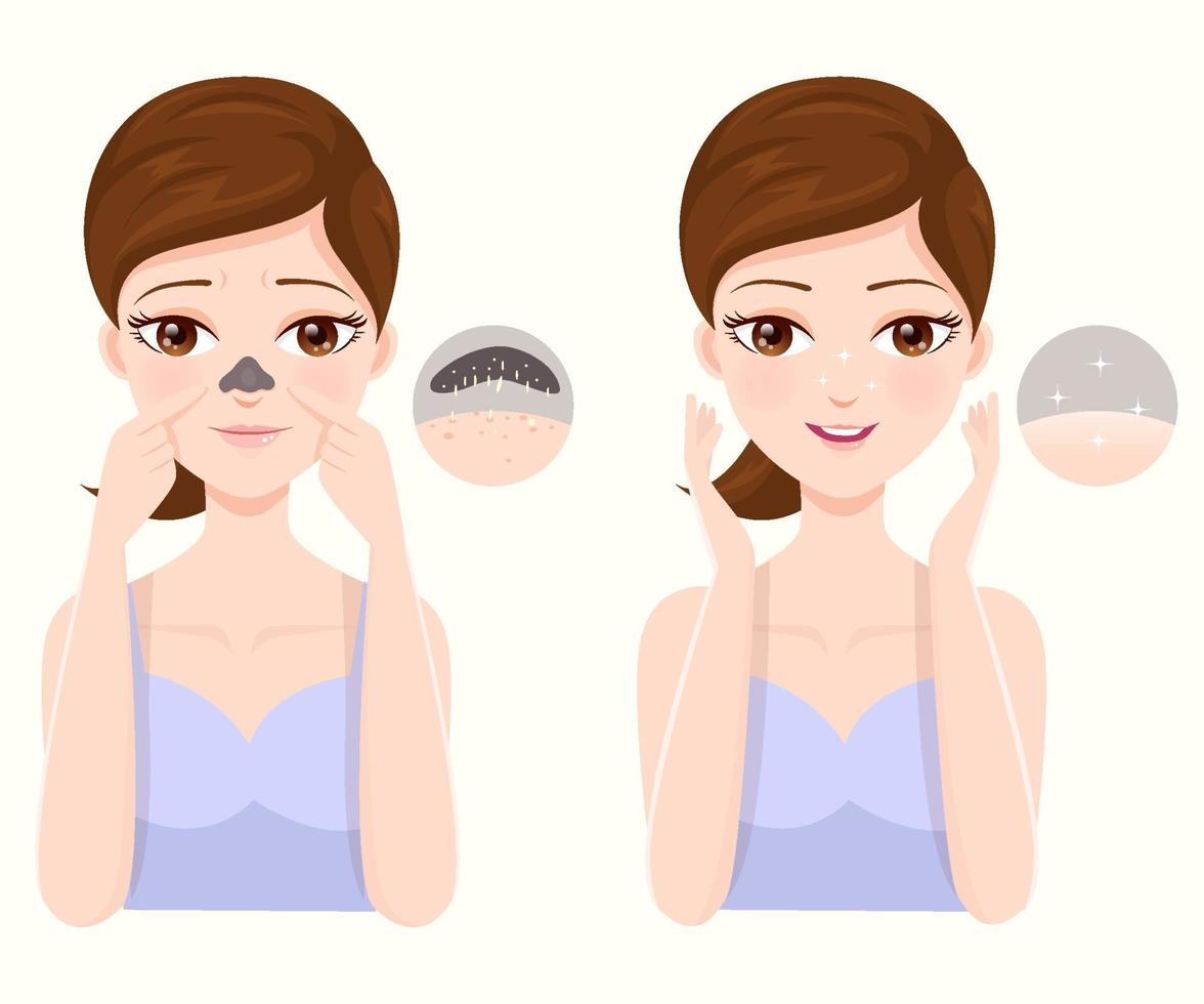 How to treat acne on clogged nose vector