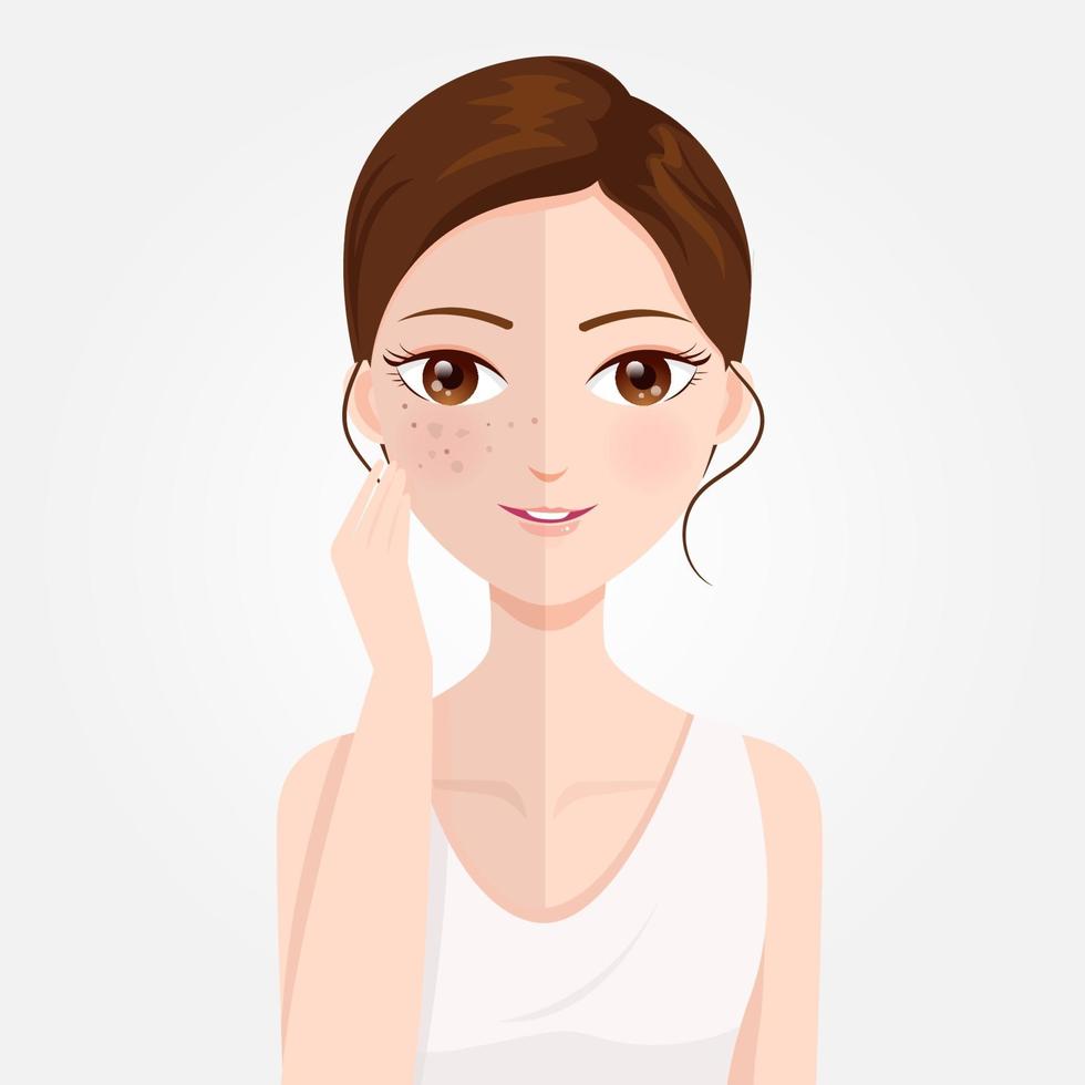 Black Spot on the face vector