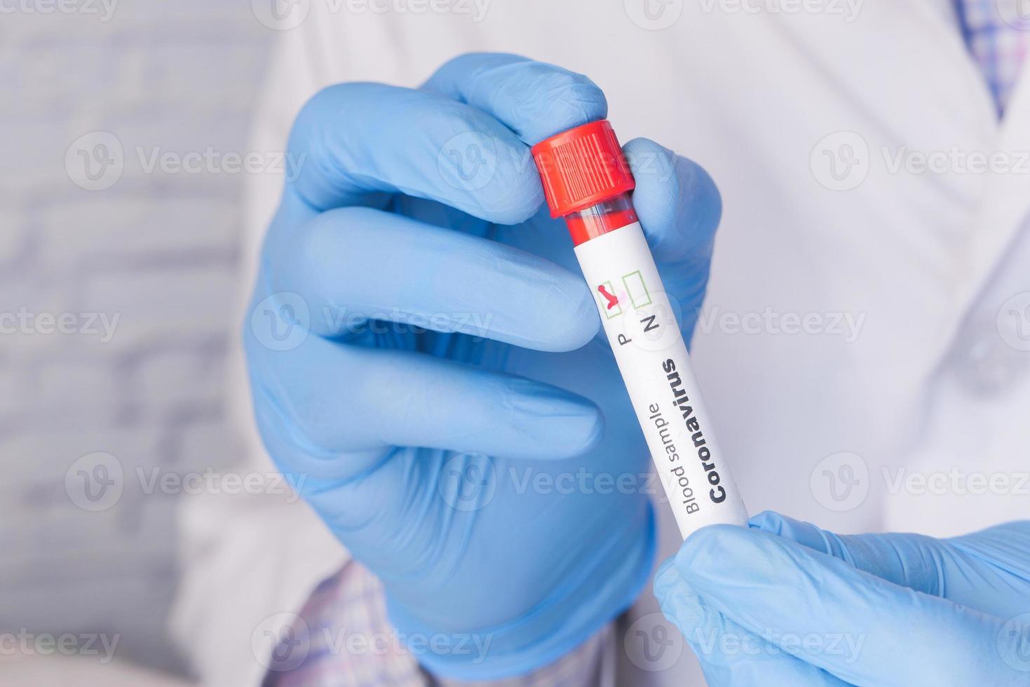 Red test tube with gloved hands 2050354 Stock Photo at Vecteezy