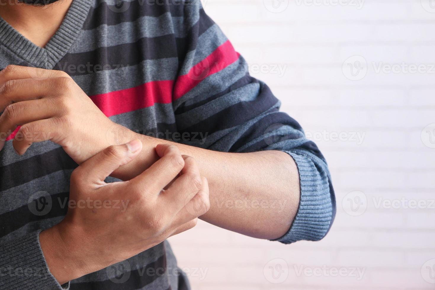 Man itching his wrist 2060067 Stock Photo at Vecteezy