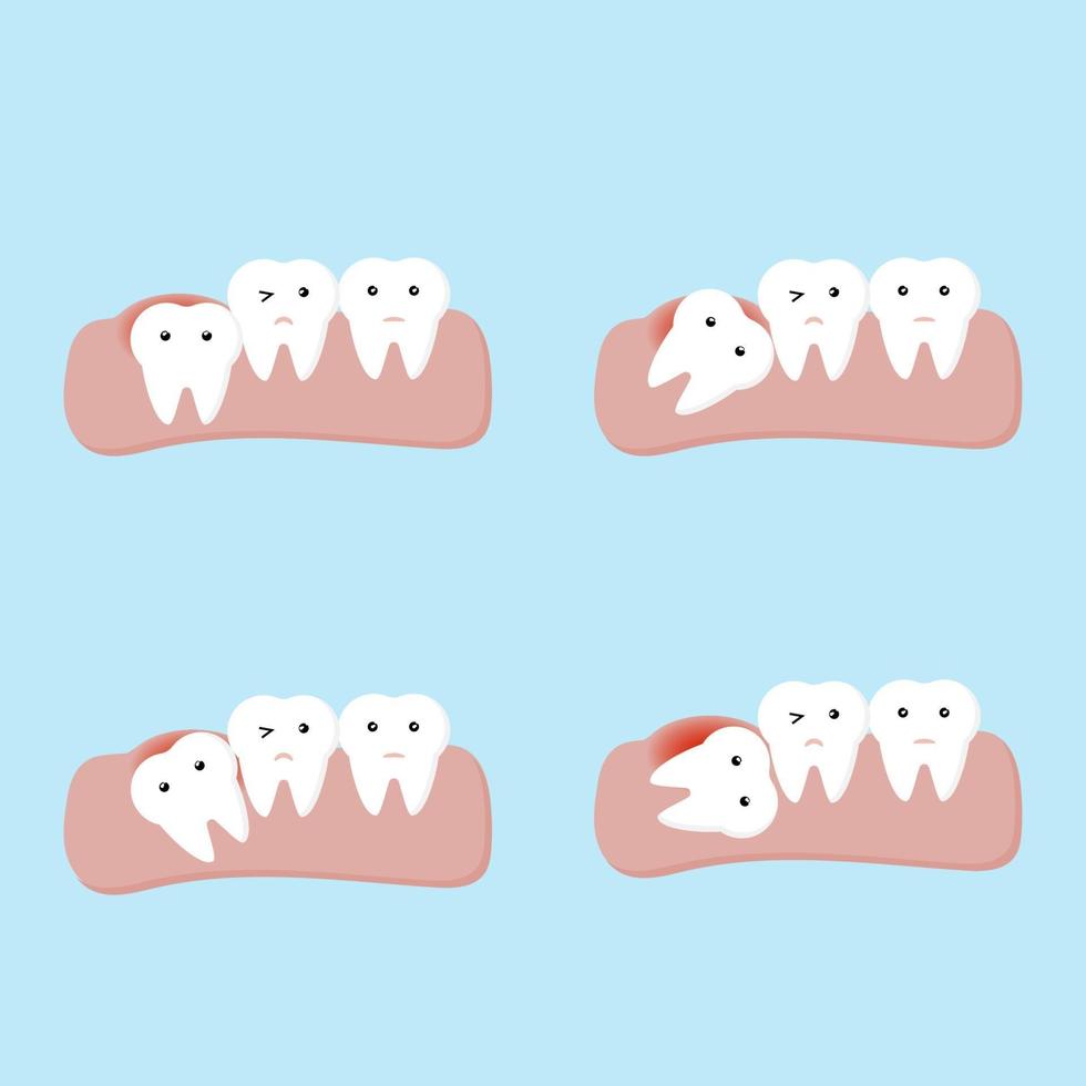 diente impactado o muelas del juicio enfermedades dentales y orales vector