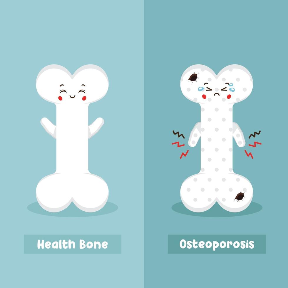 lindo hueso sano y hueso de osteoporosis vector