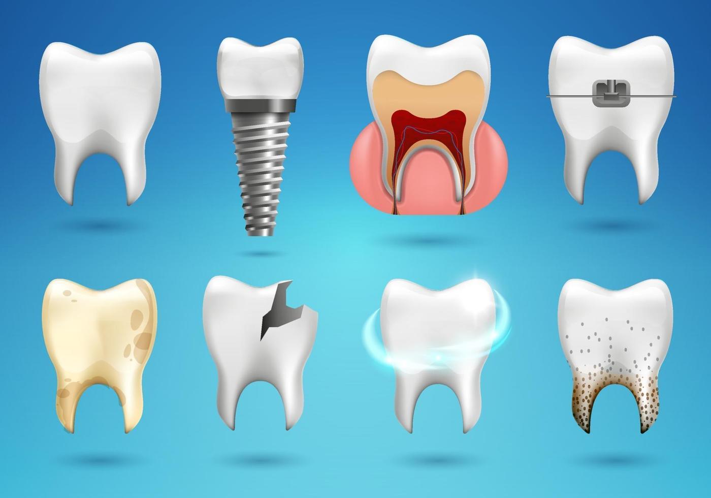 Teeth big set in 3d realistic style. Realistic healthy tooth, dental implant, caries, broken, braces. vector